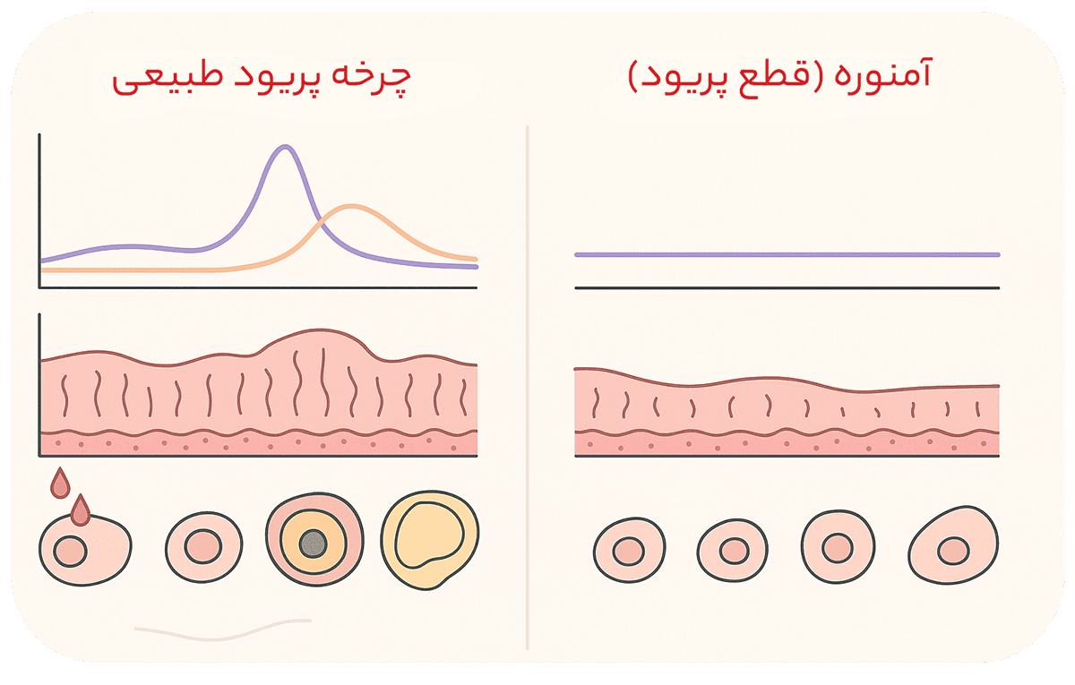 مقایسه چرخه قاعدگی طبیعی با آمنوره