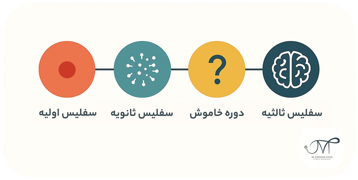 مراحل بیماری سفلیس