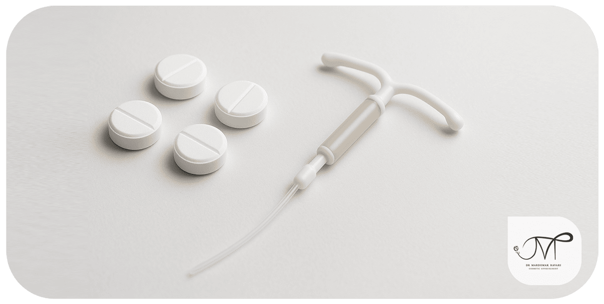درمان آندومتریوز با دارو و IUD هورمونی