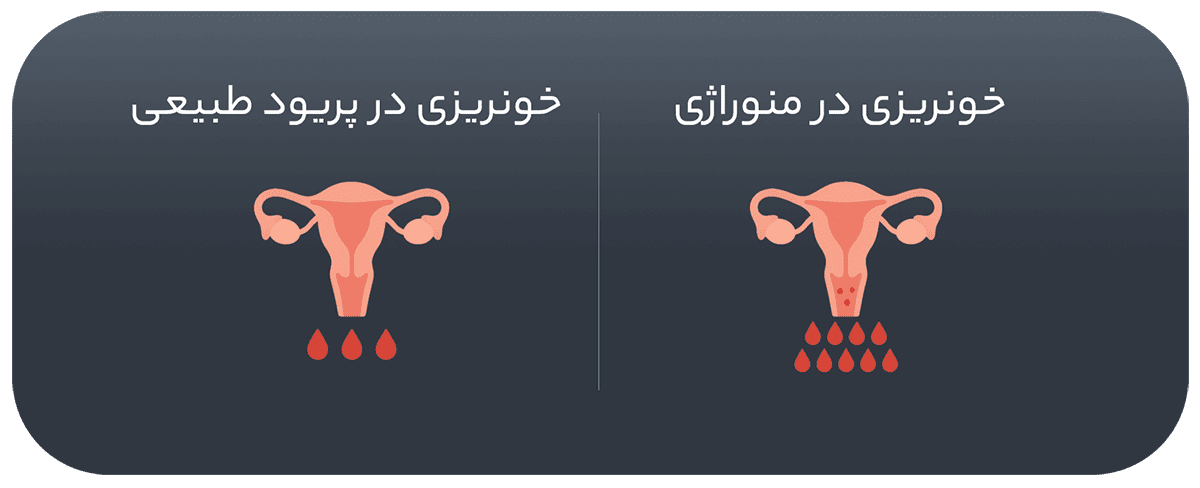 خونریزی طبیعی با منوراژی