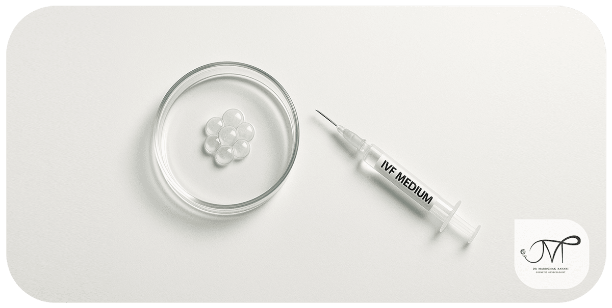 IVF برای درمان ناباروری ناشی از چسبندگی رحم
