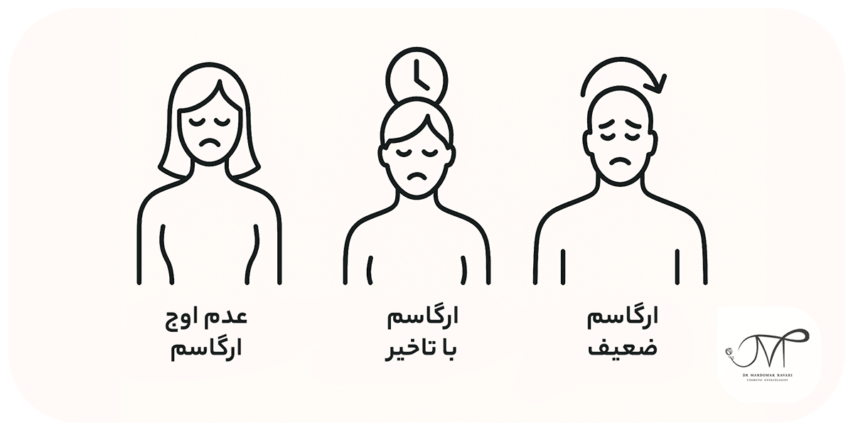 انواع اختلال ارگاسم در زنان و مردان