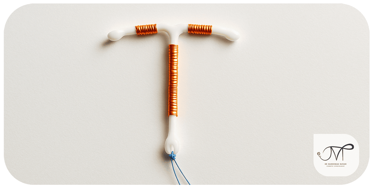 نمای نزدیک آییودی (IUD)