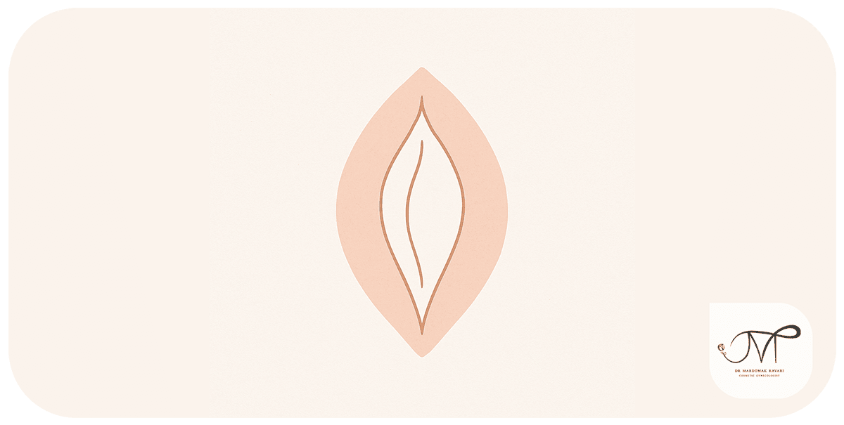 طرح شماتیک لابیا ماژور